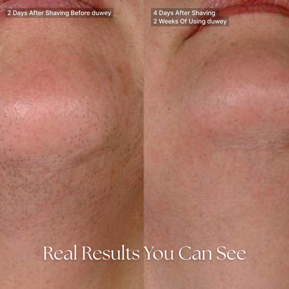 Newlvy™ Cyperus Rotundus Oil