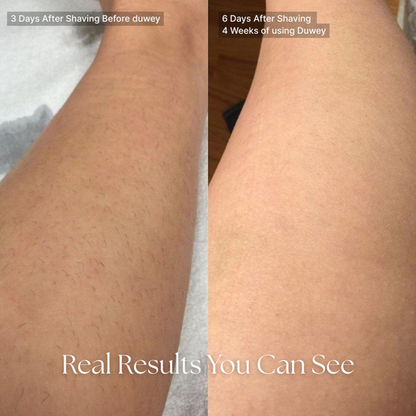 Newlvy™ Cyperus Rotundus Oil